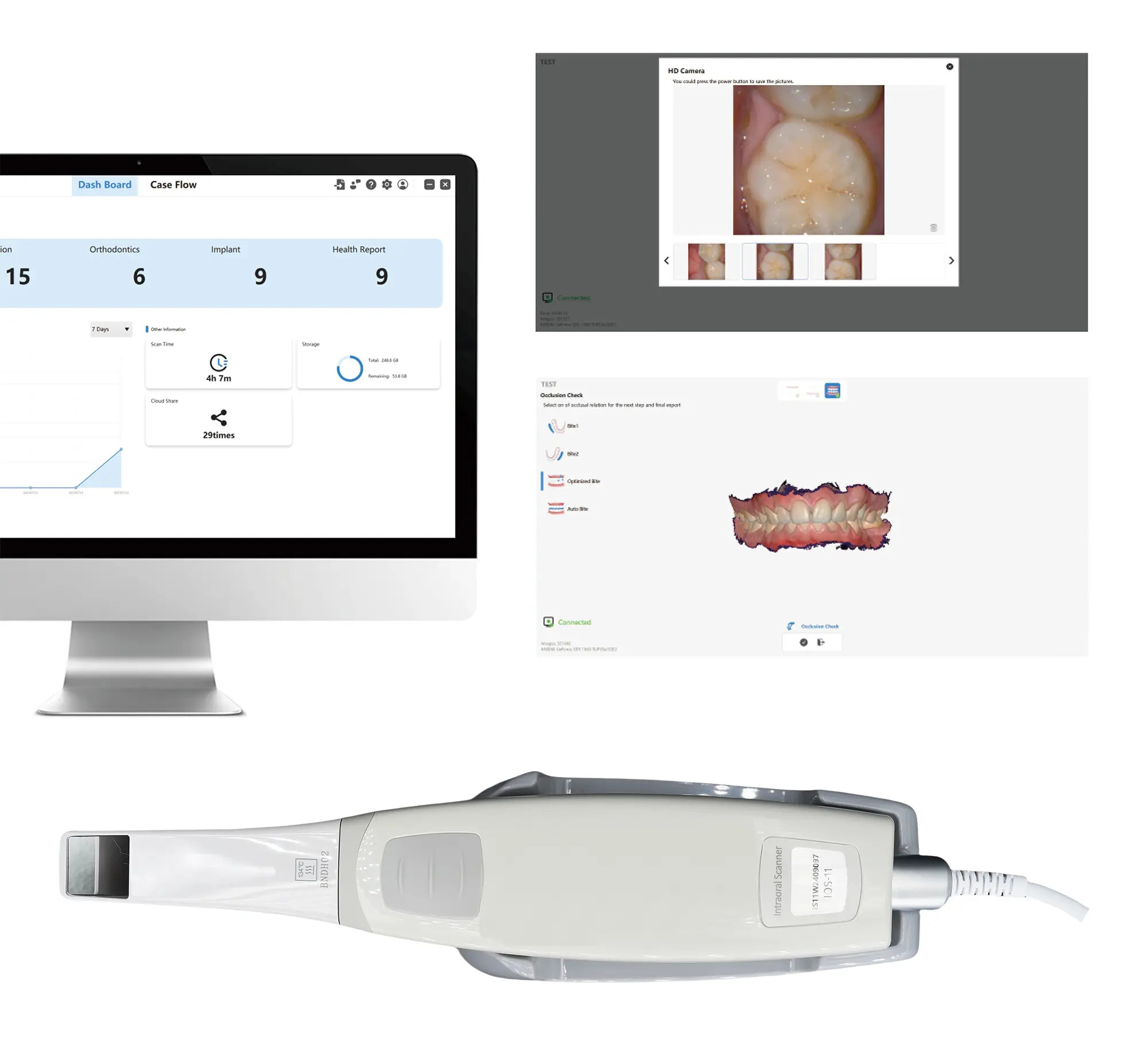 YP-11 Dental 3D Intraoral Scanner with Color Scanning for Restorative, Implant and Orthodontic